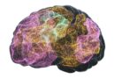 A Brain Implant for Depression Is About to Be Tested in Humans