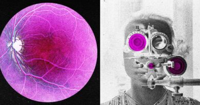 Longevity Startup Doses First Human in Bid to Reverse Age-Related Sight Loss