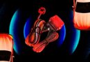 A Device Hidden in Cars Across the US Leaves Them Vulnerable to Hacking and Paralysis. Patch It Now